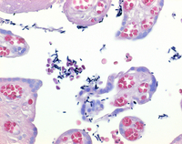 LUGOL'S SOLUTION (DILUTED IODINE-POTASS